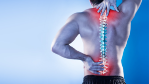 Think you have a trapped nerve and have pain in your back/buttocks?