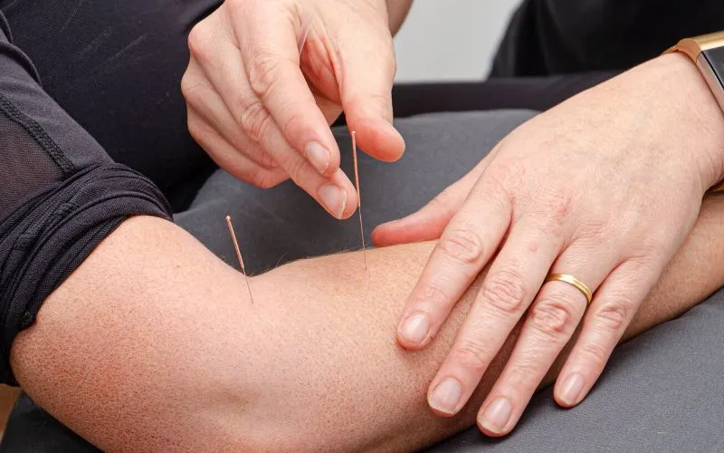 Acupuncture professional healing and pain relief services